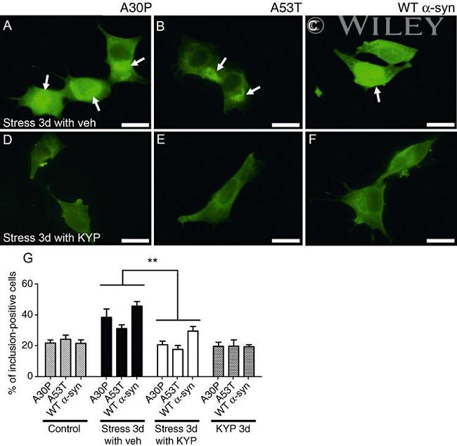 alpha Synuclein Antibody in Immunocytochemistry (ICC/IF)