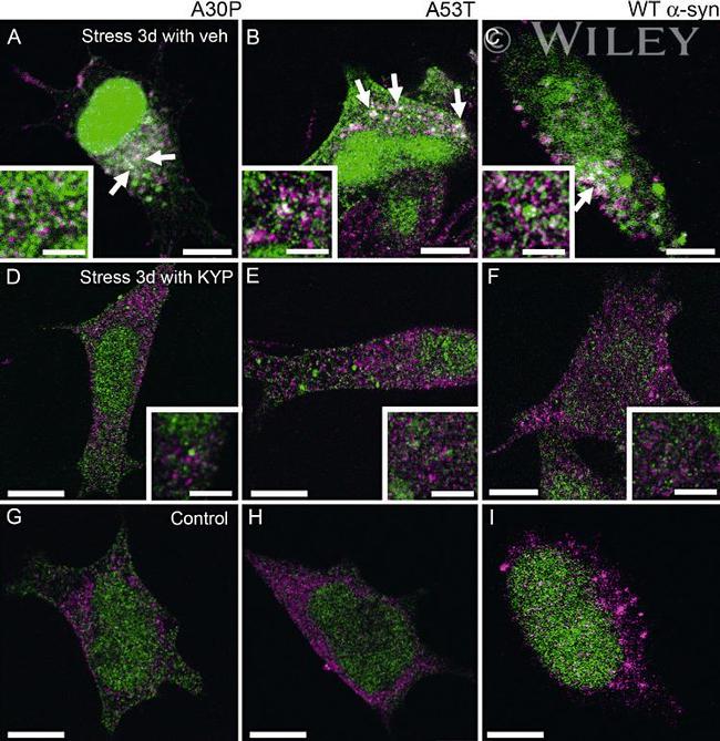 alpha Synuclein Antibody in Immunocytochemistry (ICC/IF)