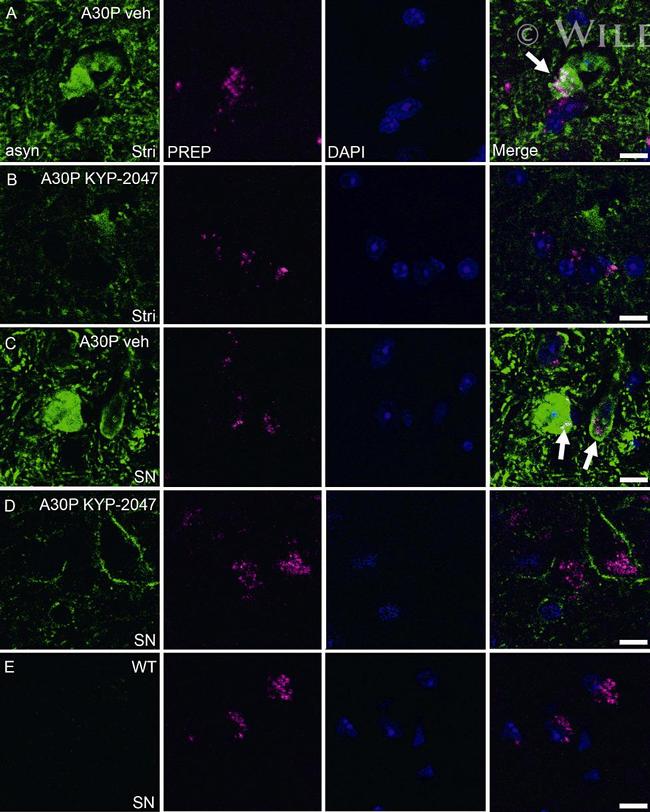 alpha Synuclein Antibody in Immunocytochemistry (ICC/IF)