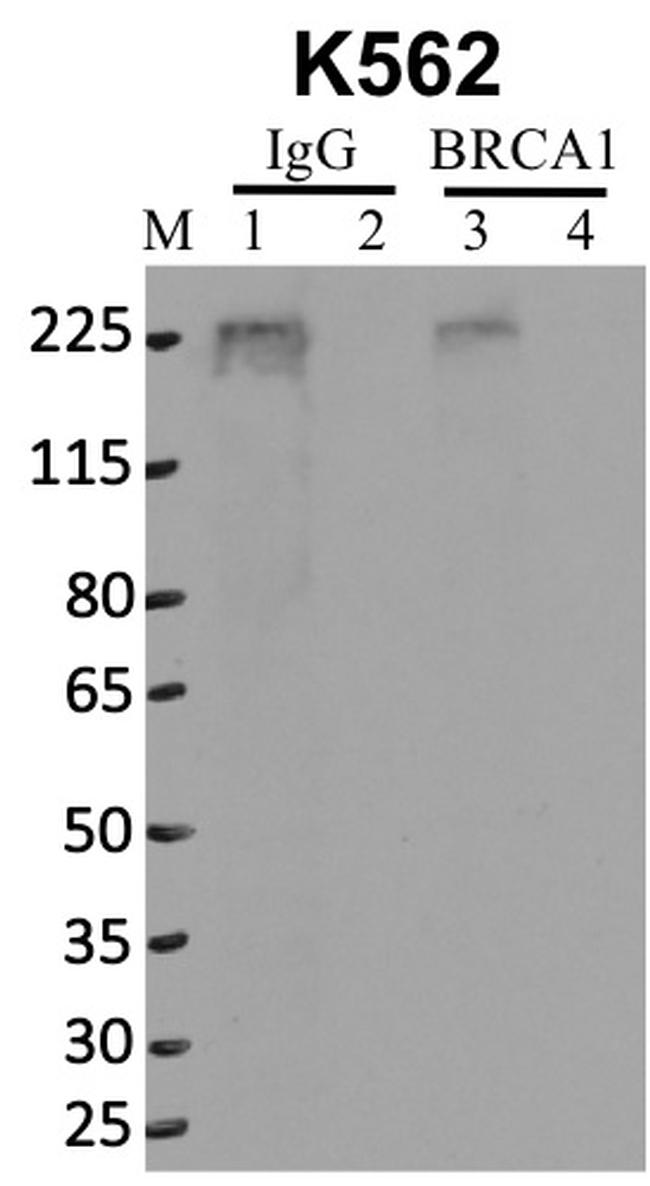 BRCA1 Antibody in RNA Immunoprecipitation (RIP)