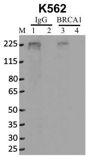 BRCA1 Antibody in Immunoprecipitation (IP)