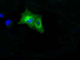 BRAF Antibody in Immunocytochemistry (ICC/IF)