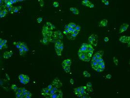 BRAF Antibody in Immunocytochemistry (ICC/IF)