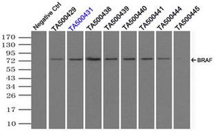 BRAF Antibody in Immunoprecipitation (IP)