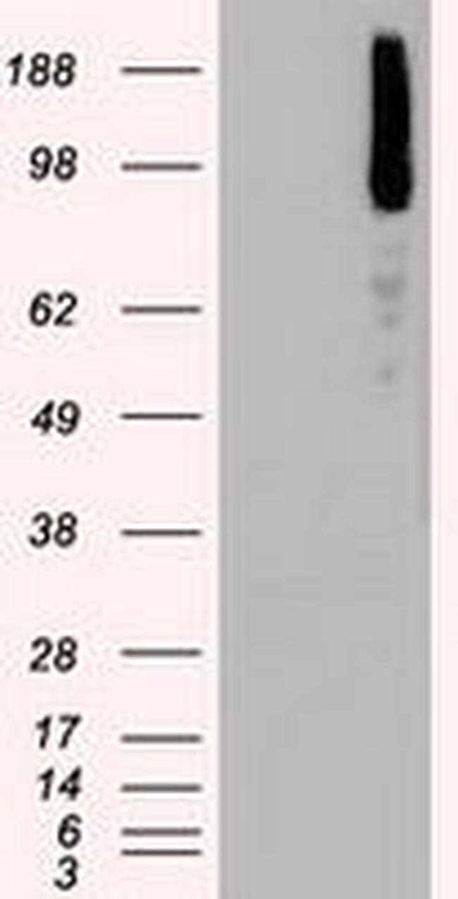 BRAF Antibody in Western Blot (WB)