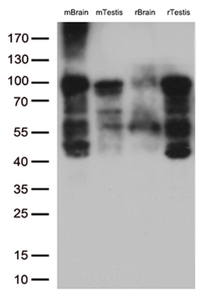 BRAF Antibody in Western Blot (WB)