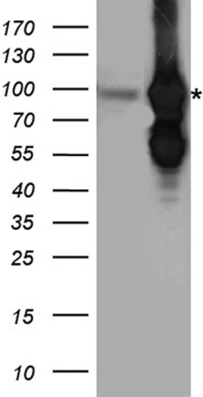 BRAF Antibody in Western Blot (WB)