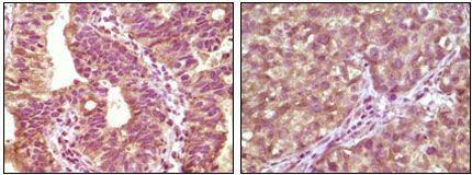 B-Raf Antibody in Immunohistochemistry (Paraffin) (IHC (P))