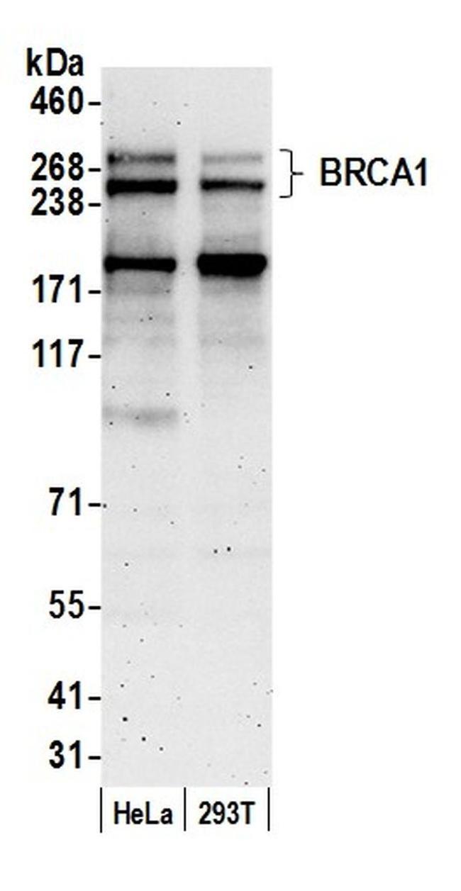 BRCA1 Antibody in Western Blot (WB)