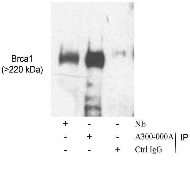 BRCA1 Antibody in Western Blot (WB)