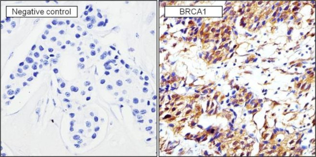 BRCA1 Antibody in Immunohistochemistry (Paraffin) (IHC (P))