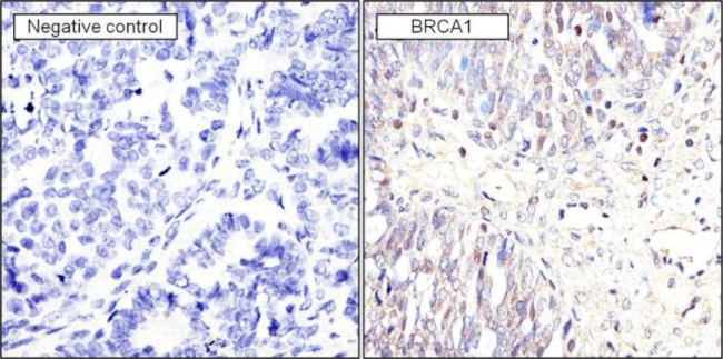 BRCA1 Antibody in Immunohistochemistry (Paraffin) (IHC (P))