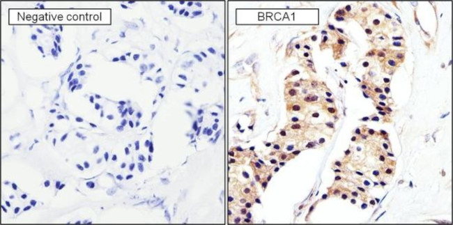 BRCA1 Antibody in Immunohistochemistry (Paraffin) (IHC (P))