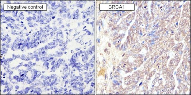 BRCA1 Antibody in Immunohistochemistry (Paraffin) (IHC (P))