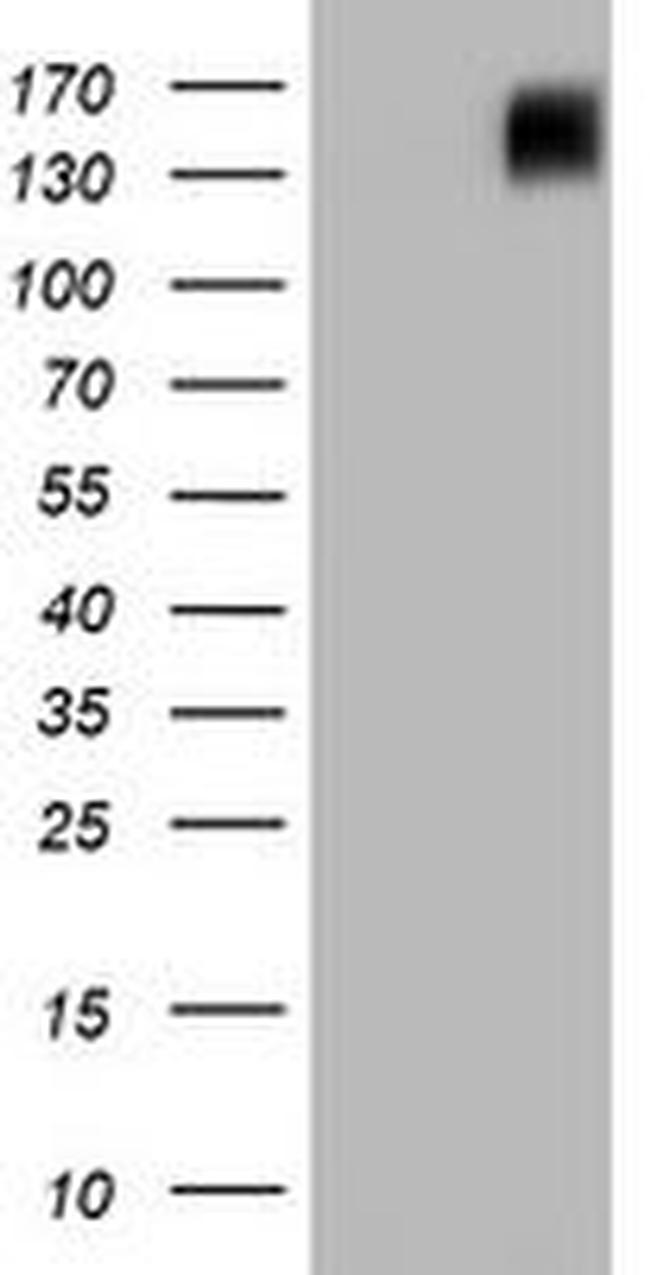 BRCA1 Antibody in Western Blot (WB)