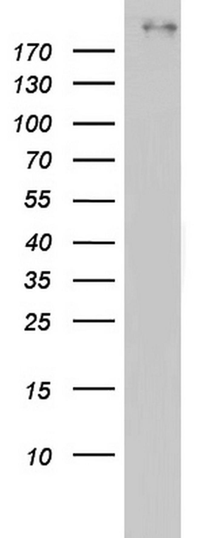 BRCA1 Antibody in Western Blot (WB)