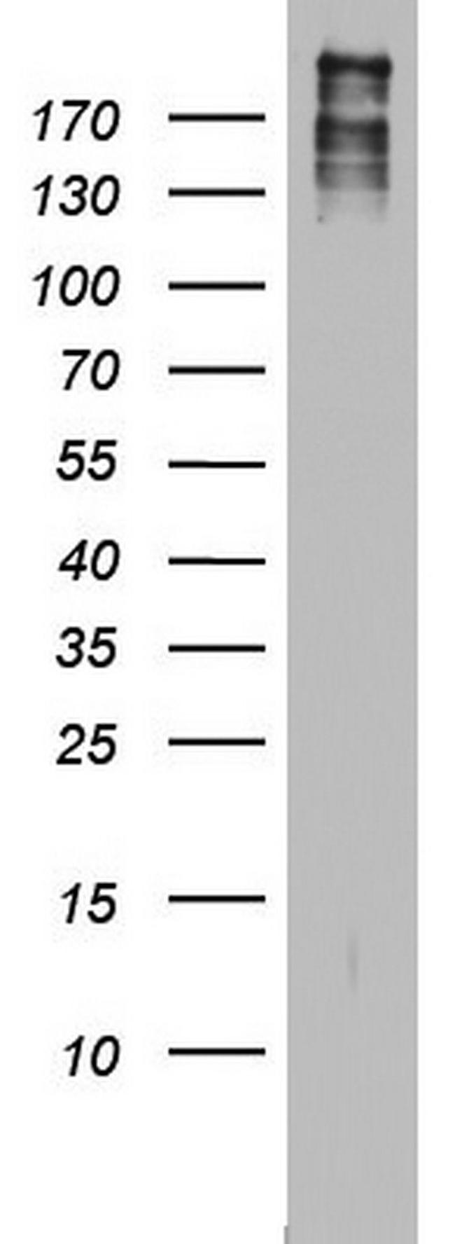 BRCA1 Antibody in Western Blot (WB)