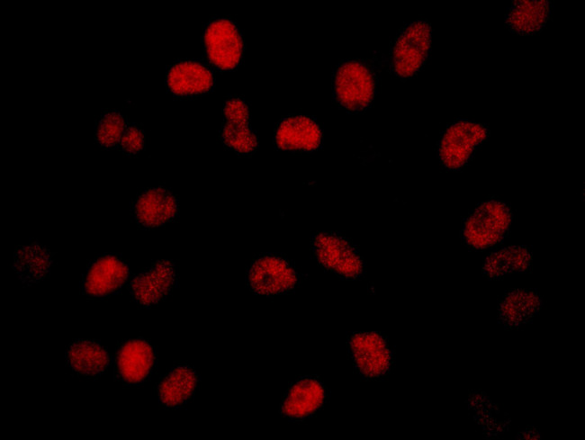 BRD2 Antibody in Immunocytochemistry (ICC/IF)