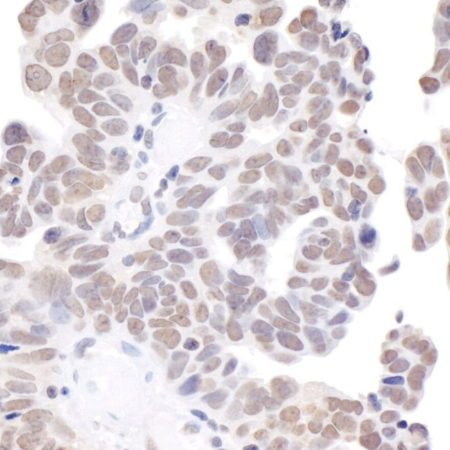 BRD2 Antibody in Immunohistochemistry (IHC)