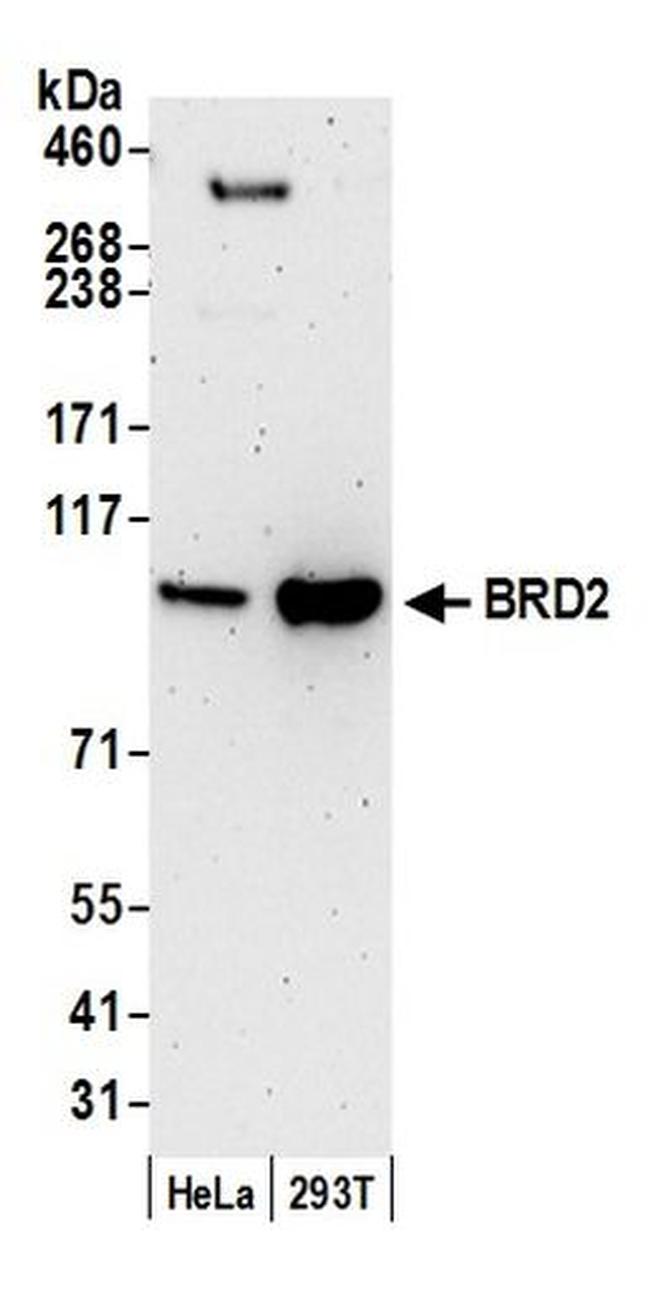 BRD2 Antibody in Western Blot (WB)