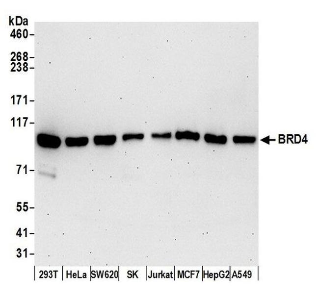 BRD2 Antibody in Western Blot (WB)