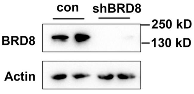 BRD8 Antibody in Western Blot (WB)