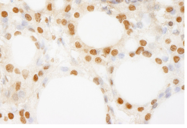 BRF1 Antibody in Immunohistochemistry (IHC)