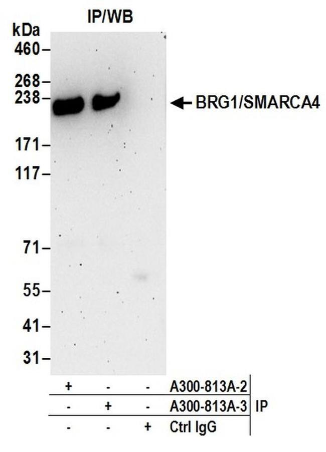 BRG1/SMARCA4 Antibody in Western Blot (WB)