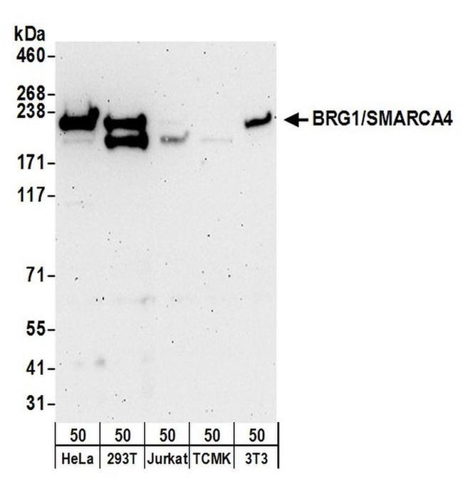 BRG1/SMARCA4 Antibody in Western Blot (WB)