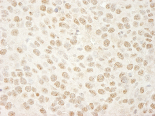 BRG1/SMARCA4 Antibody in Immunohistochemistry (IHC)