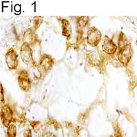 Bombesin Receptor 3 Antibody in Immunohistochemistry (Paraffin) (IHC (P))