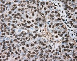 BSG Antibody in Immunohistochemistry (Paraffin) (IHC (P))