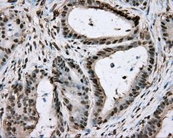 BSG Antibody in Immunohistochemistry (Paraffin) (IHC (P))