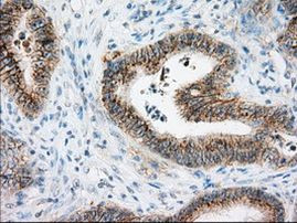 BSG Antibody in Immunohistochemistry (Paraffin) (IHC (P))