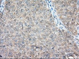 BSG Antibody in Immunohistochemistry (Paraffin) (IHC (P))