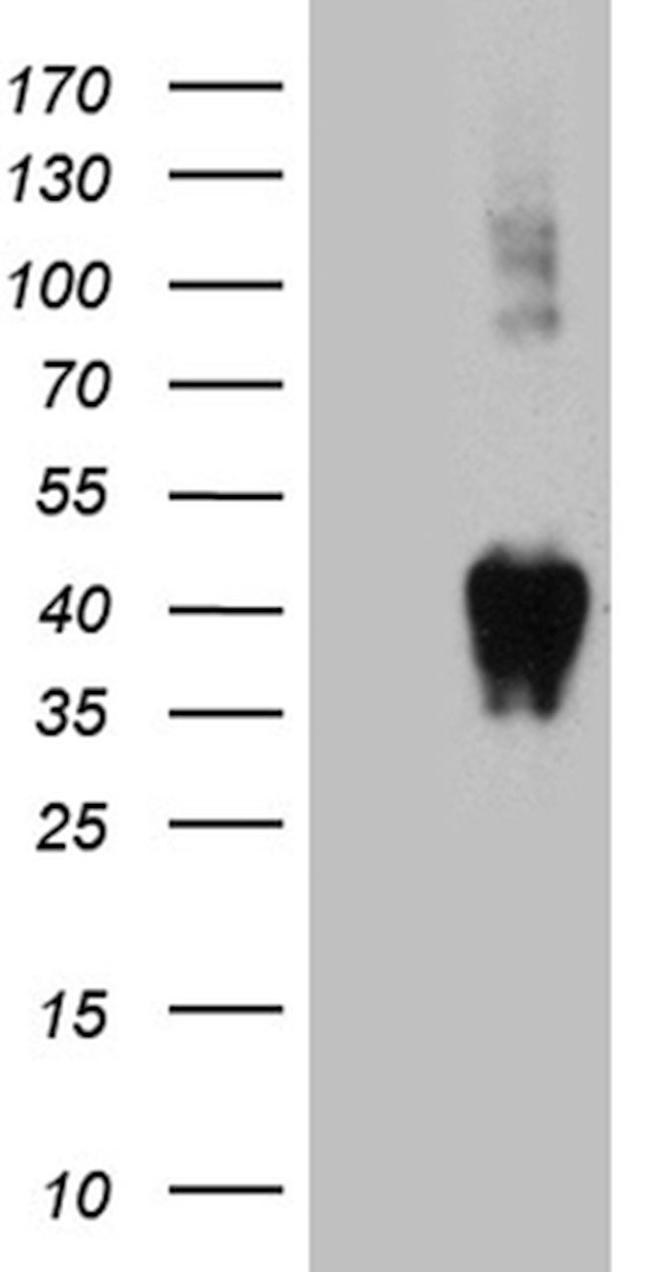 BST1 Antibody in Western Blot (WB)