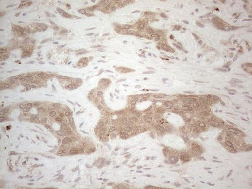 BTBD10 Antibody in Immunohistochemistry (Paraffin) (IHC (P))