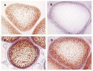 Procollagen IIA N-Peptide Antibody in Immunohistochemistry (Paraffin) (IHC (P))