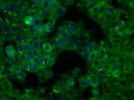 BTK Antibody in Immunocytochemistry (ICC/IF)