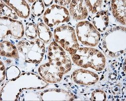 BTK Antibody in Immunohistochemistry (Paraffin) (IHC (P))