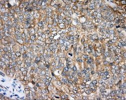 BTK Antibody in Immunohistochemistry (Paraffin) (IHC (P))