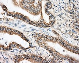 BTK Antibody in Immunohistochemistry (Paraffin) (IHC (P))