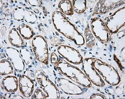 BTK Antibody in Immunohistochemistry (Paraffin) (IHC (P))