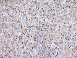 BTK Antibody in Immunohistochemistry (Paraffin) (IHC (P))