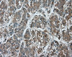 BTK Antibody in Immunohistochemistry (Paraffin) (IHC (P))