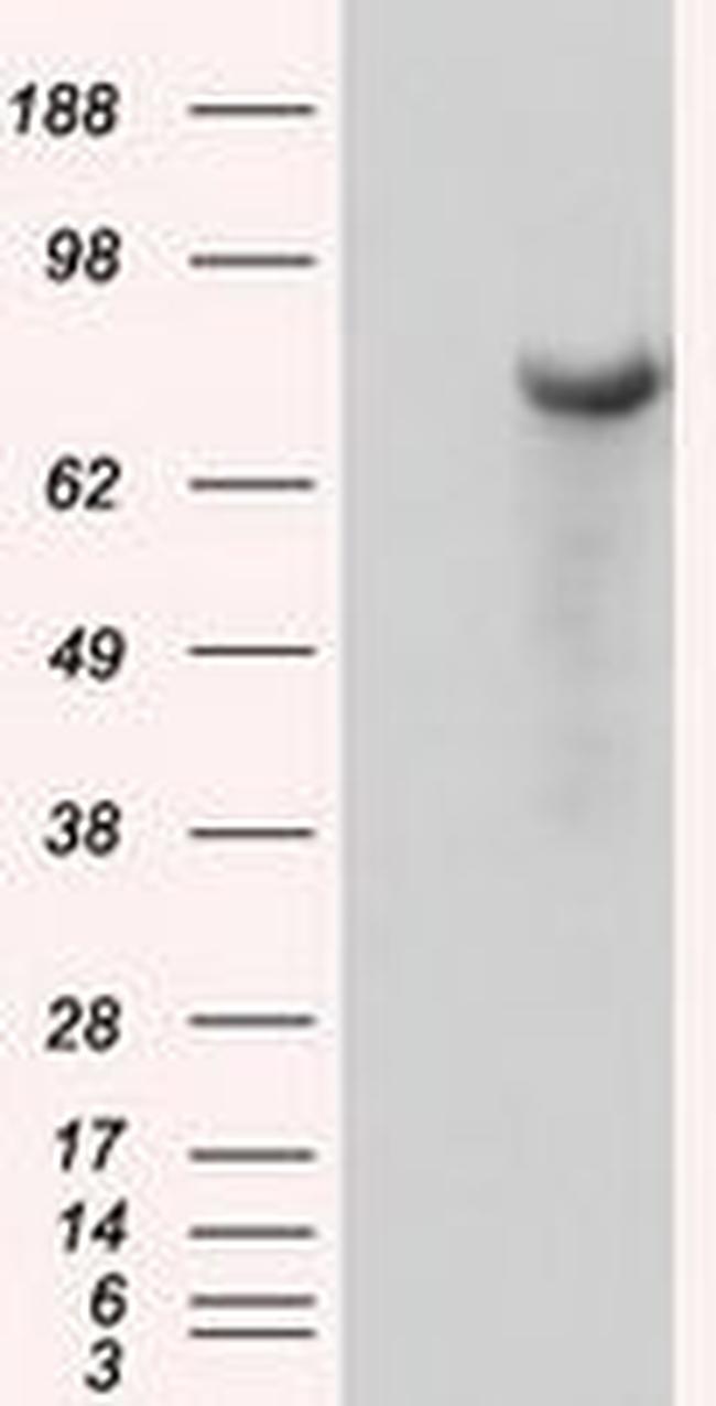 BTK Antibody in Western Blot (WB)