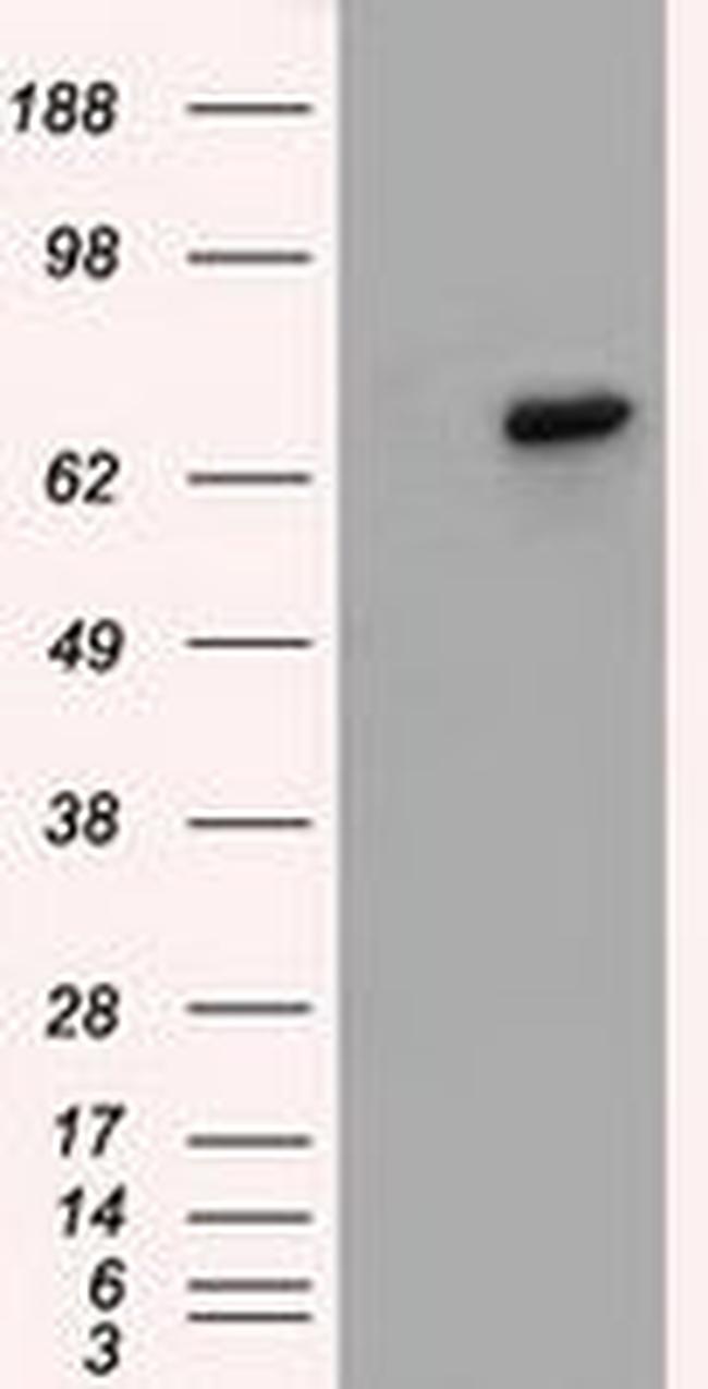 BTK Antibody in Western Blot (WB)