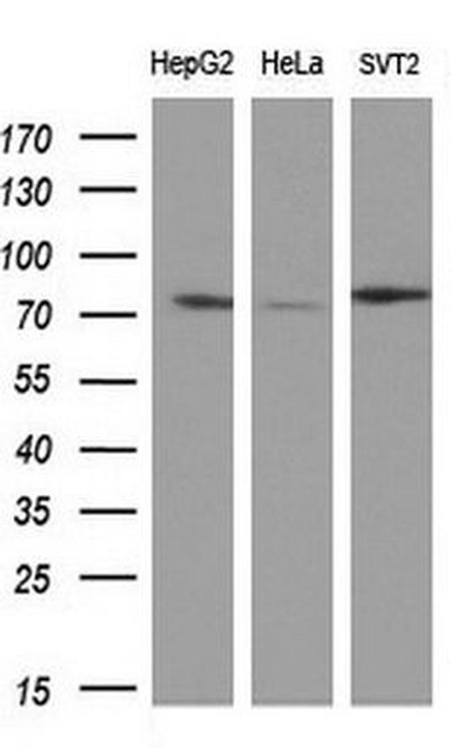 BTK Antibody in Western Blot (WB)