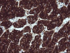 BTLA Antibody in Immunohistochemistry (Paraffin) (IHC (P))