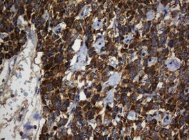 BTLA Antibody in Immunohistochemistry (Paraffin) (IHC (P))